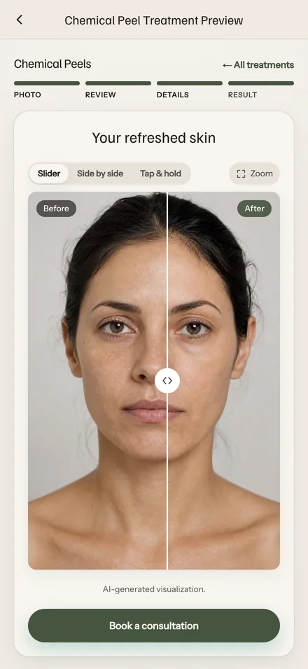 A chemical-peel simulation as a drag-to-compare wipe across the client's own photograph, above a button to request a consultation